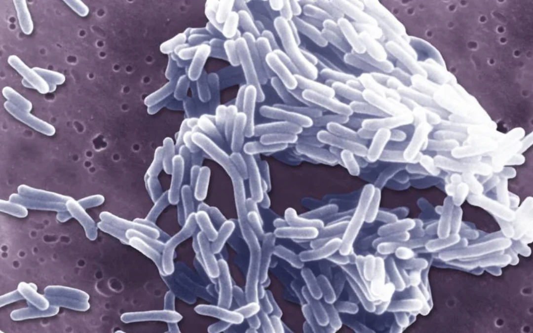 Listeria: el patógeno que trae de cabeza a la industria alimentaria