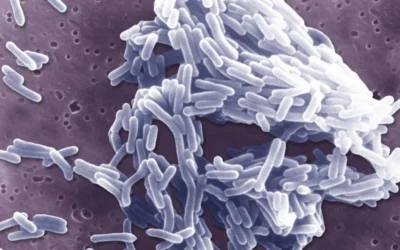 Listeria: el patógeno que trae de cabeza a la industria alimentaria